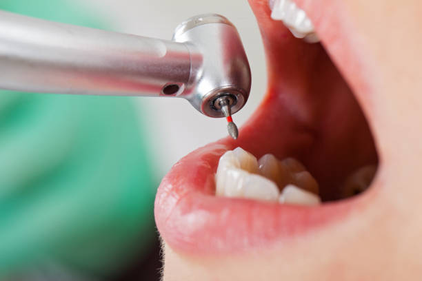 Tooth Infection Emergency Dentist in AK